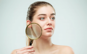 Google lens skin condition